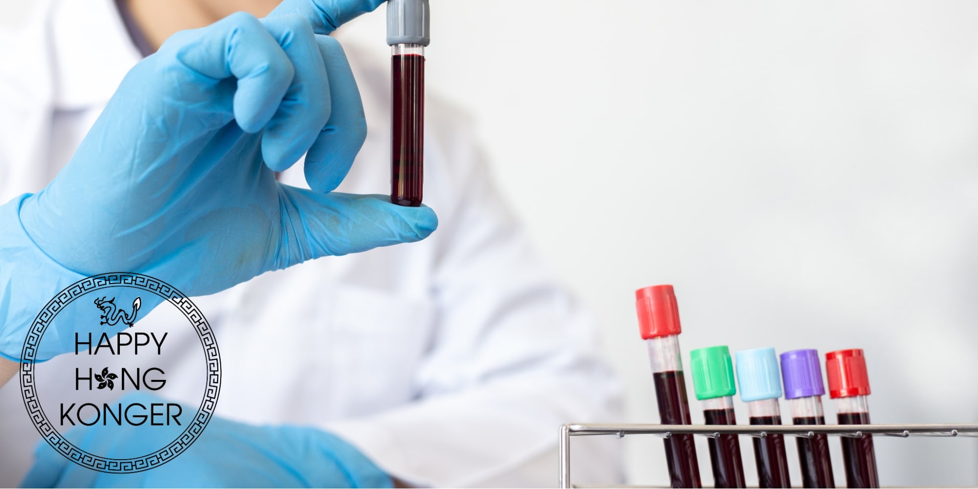 Blood Test in Hong Kong Where to Get Tested